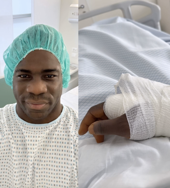 Balotelli si è operato alla mano (Instagram)