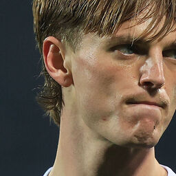 Copertina: Fiorentina, Gudmundsson costretto al cambio